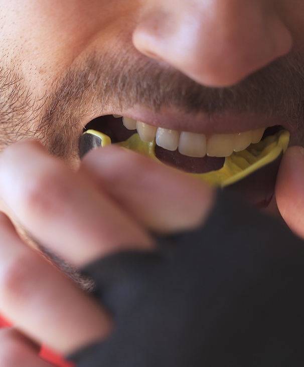 Pourquoi porter un protecteur buccal ? Pourquoi porter un protecteur buccal ?